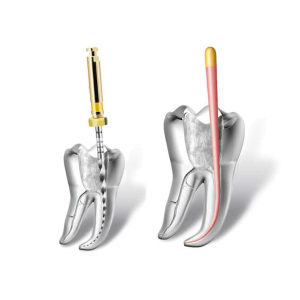 Ендодонтія